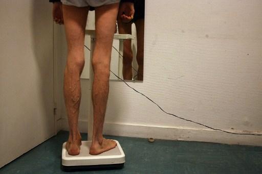 En anorektisk kvinna väger sig på sjukhuset den 12 februari 2007 på ett sjukhus i Paris. Med tidig upptäckt och snabb behandling är det möjligt att undgå de allvarliga riskerna som självsvält kan leda till. (Foto: Joel Saget/AFP)