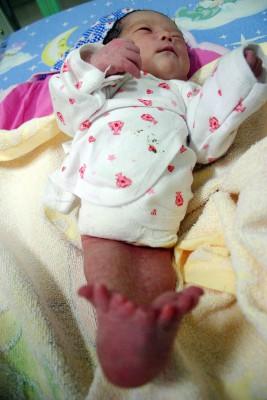En missbildad pojke med sjöjungfru-syndrom som övergetts och inkommit på barnsjukhuset i Hunan-provinsen. Enligt experter föds fler barn idag missbildade, till följd av miljöföroreningar. (Foto: China out Getty out / AFP)