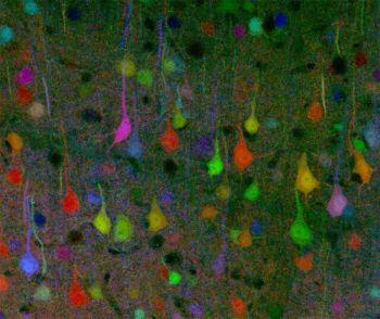 Nervceller eller neuroner som de på bilden formar kommunikationssystem som fungerar likt sociala nätverk. (Foto:AFP/Getty Images)