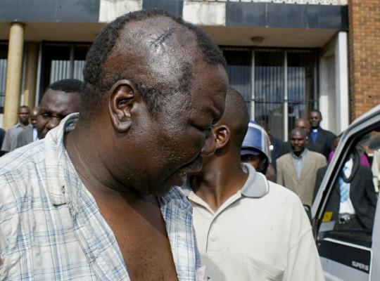 Zimbabwes oppositionsledare Morgan Tsvangirai togs den 13 mars 2007 till sjukhus i polisbil från Harares domstol. Hans skallben är enligt läkarundersökning spräckt. Han är satt på fri fot. (Foto: AFP/Desmond Kwande)
