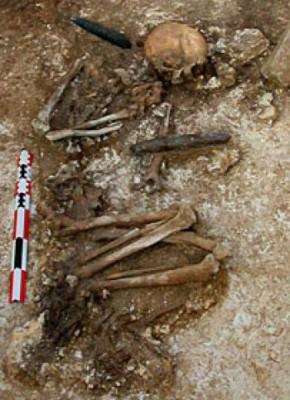 Forskarna har hittat bevis för att sofistikerad amputation utfördes på detta skelett från stenåldern. (Med benäget tillstånd av Antiquity Journal)