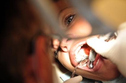 En ren frisk munhåla med hela tänder är vad vi helst önskar oss. Trots noggrann och daglig tandborstning drabbas vi ibland av problem med tänderna och måste besöka tandläkaren.  Nu har brittiska forskare upptäckt att enzymer i alger kan skydda mot karies. (Foto: AFP/Attila Kisbenedek)
