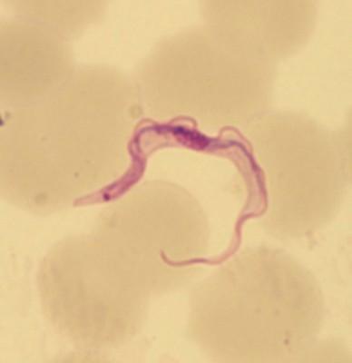 Förstoring av trypanosoma brucei trypomastigot. (Foto: Berit Schmidt-Aydin, Smittskyddsinstitutet)
