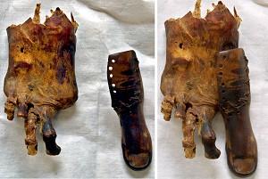 Arkeologer har nyligen upptäckt vad tror vara den äldsta kända protesen i världen. (Foto: Marwan Naamani/AFP/Getty Images)