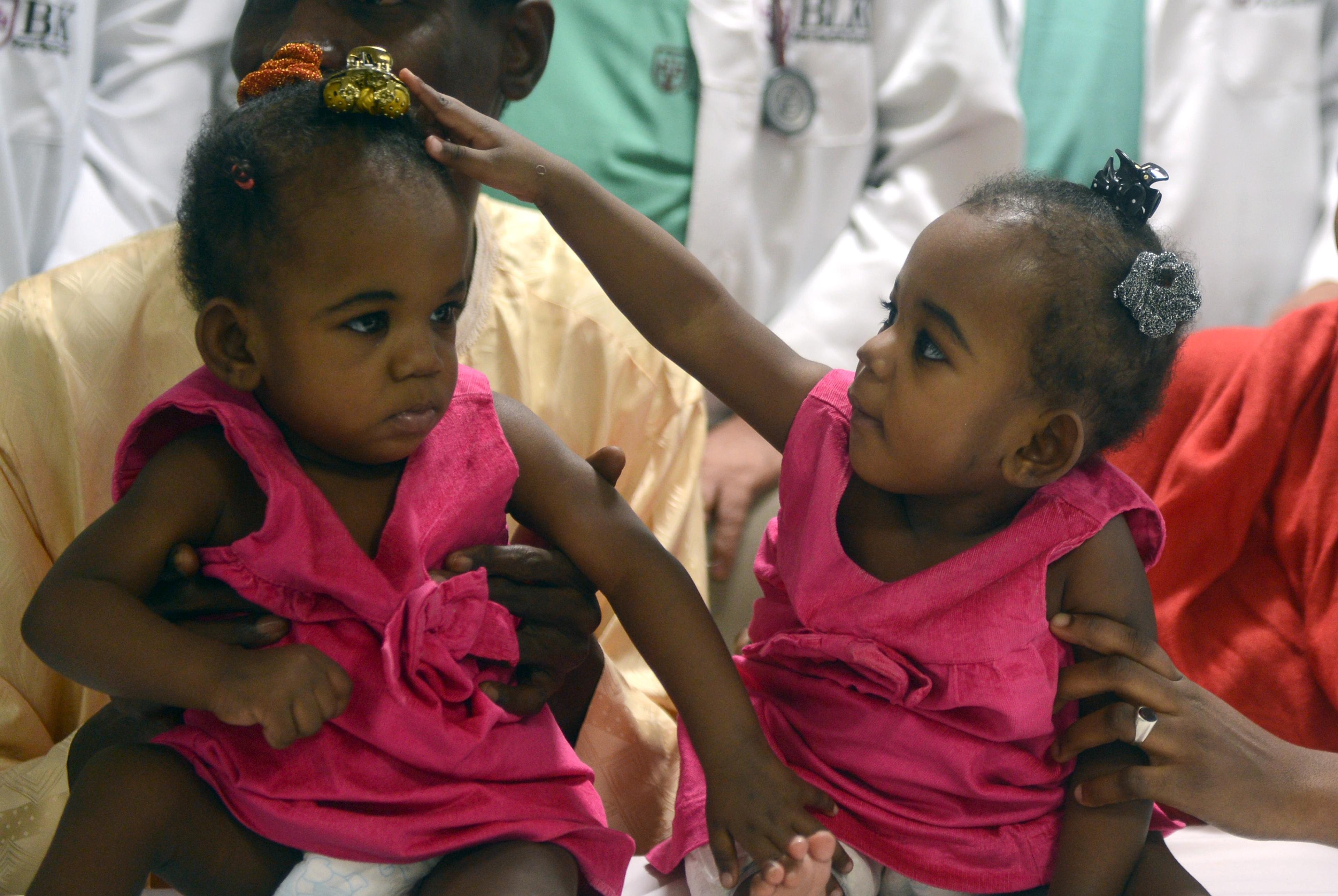Redan i fosterstadiet börjar tvillingar ta kontakt med varandra, visar forskning. (Foto: Raveendran /AFP/Getty Image)