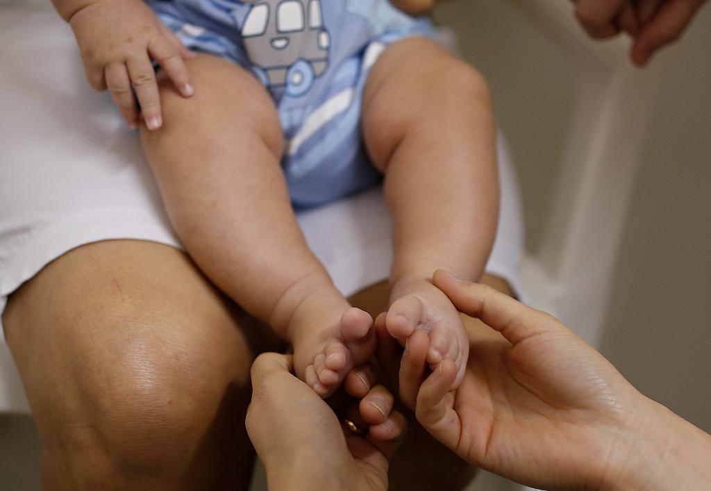 Brasilien bekräftar 641 fall av mikrocefali - som innebär att barn föds med onormalt små hjärnor. (Foto: Andre Penner /AP/TT-arkivbild)