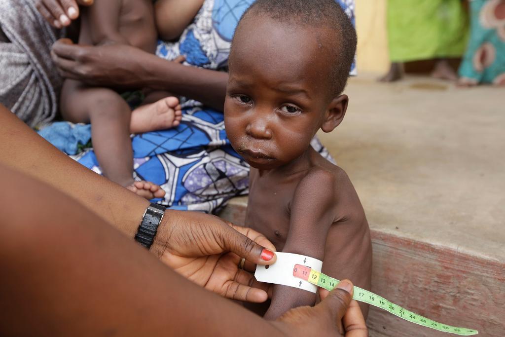 Enligt Läkare utan gränser är situationen katastrofal för 15 000 barn i ett flyktingläger i staden Bama i nordöstra Nigeria. (Foto: Sunday Alamba /AP/TT-arkivbild)