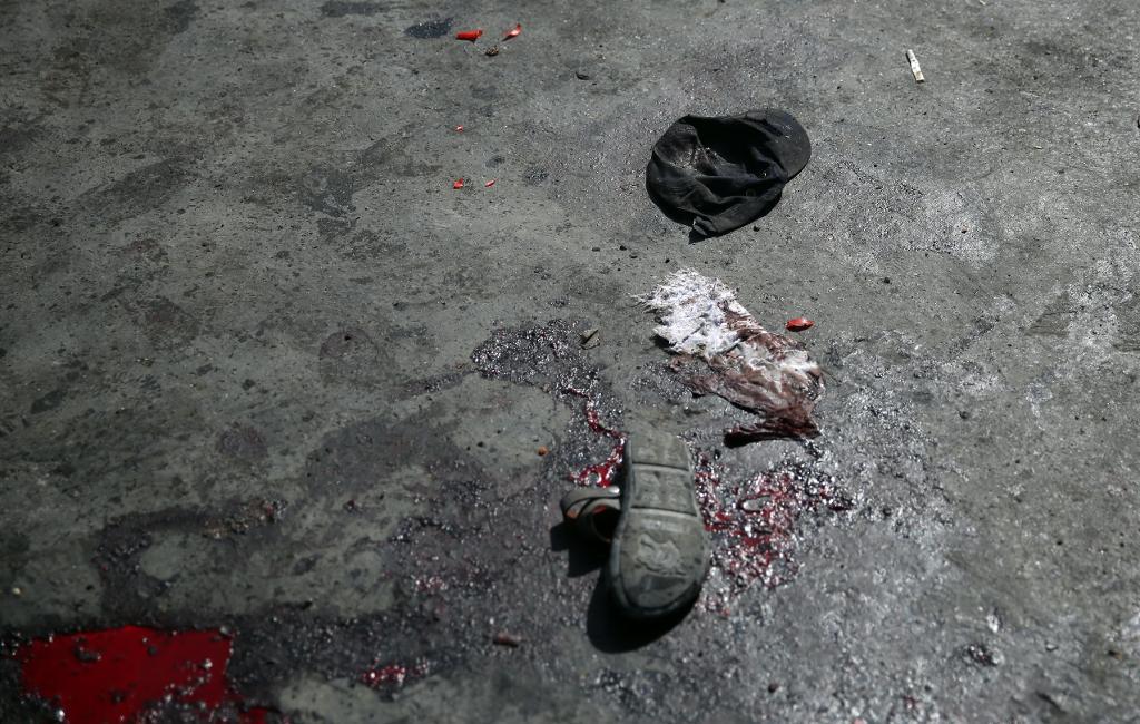 Minst 80 människor dödades i Kabul i går, på lördagen.
Massoud Hossaini/AP/TT