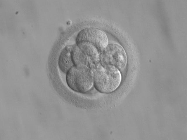 Ett embryo med åtta celler.  Vid mitokondriebyte sätts moderns cellkärna in i ett donerat ägg. Det blivande barnet får då dna från tre föräldrar.(Foto: Wikimedia)