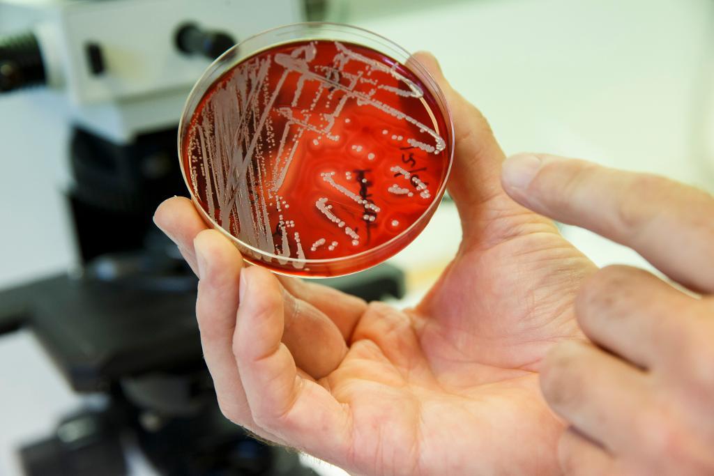 Antibiotikaresistenta så kallade MRSA-bakterier. (Foto: Cornelius Poppe /NTB scanpix/TT-arkivbild)