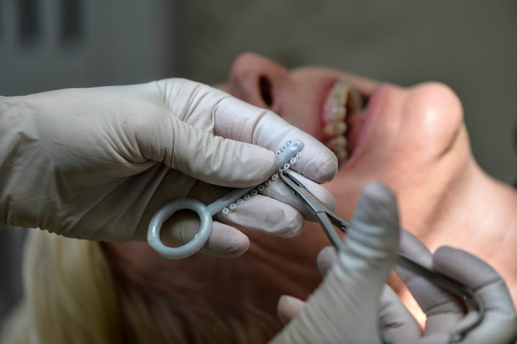 Notan för nya behandlingar kan drabba patienterna, trots att en anmäld tandläkare har försäkring. (Foto: Anders Wiklund/ TT-arkivbild)