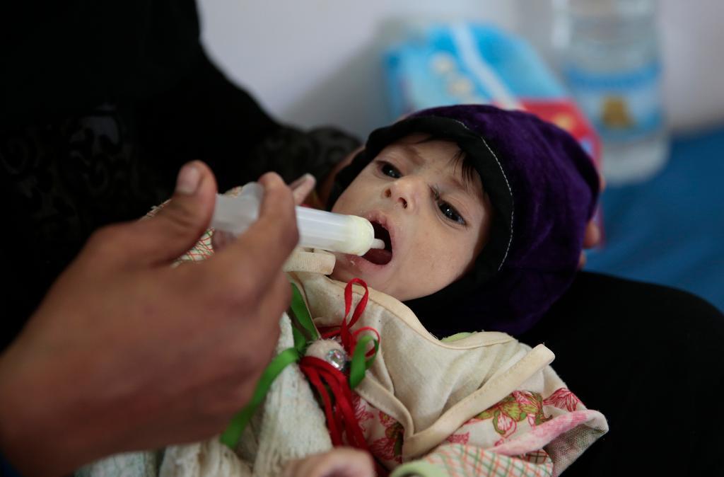 En jemenitisk flicka som lider av undernäring får mat av sin mamma på ett sjukhus i provinsen Saada, nordväst om huvudstaden Sanaa. (Foto: Hani Mohammed/AP/TT-arkivbild)