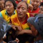 En skadad munk efter en fredlig vädjan framför den kinesiska ambassaden i Katmandu den 10 augusti, 2008. Vid detta tillfälle arresterade polisen över 250 tibetaner utanför konsulatet och handelsutbyteskontoren. (Foto: AFP/Prakash Mathema)