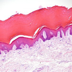 Hud. Tvärsnitt av en mänsklig hudcell. (Shutterstock*)