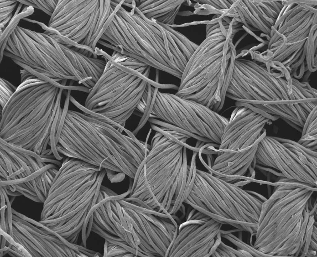 Närbild av nanostrukturer som odlats på bomullstextilier av forskare på RMIT University. Bilden är förstorad 150 000 gånger. (Foto: RMIT University)