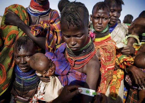 En bild tagen av UNICEF visar en ammande mamma som mäts för att se om hon är undernärd på ett centrum nära Lodwar, Turkana den 15 juli. (Foto: Kate Holt/UNICEF/AFP)