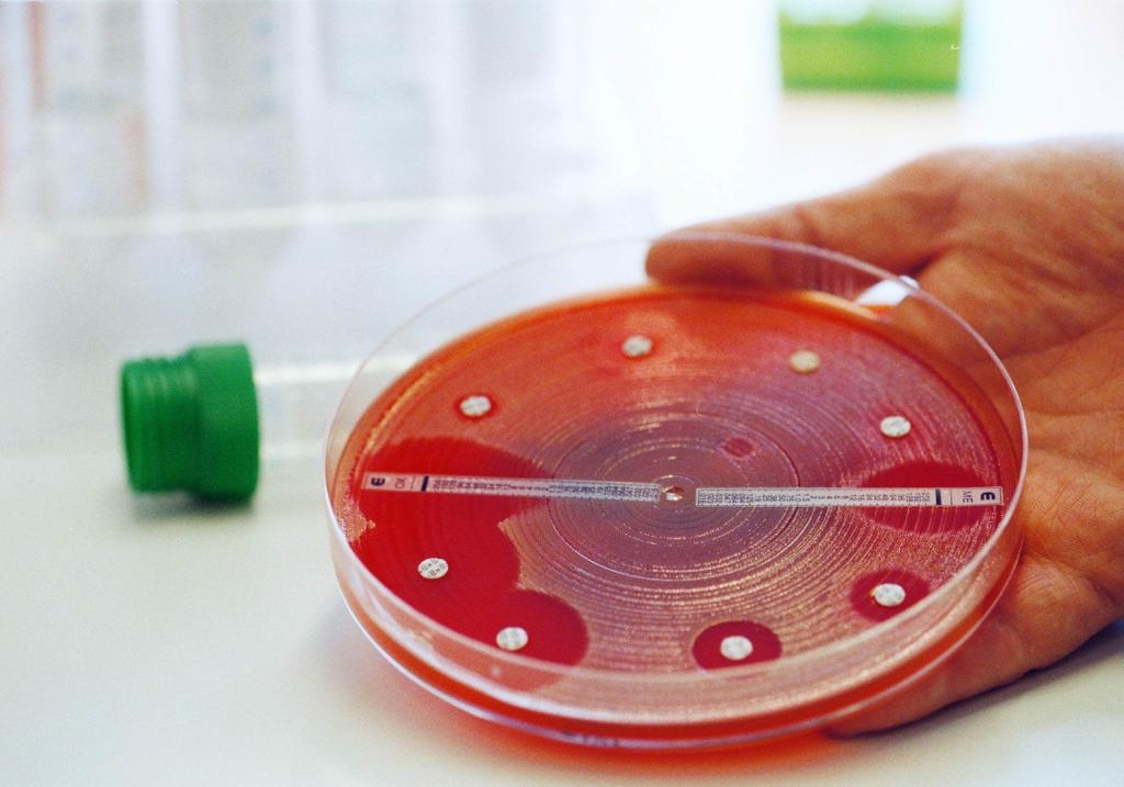 På grund av flyktingsituationen ökade antalet fall av MRSA kraftigt förra året. (Foto: Håkan Lindgren)