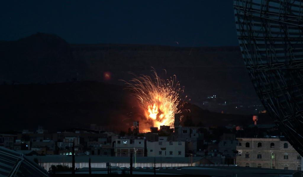 Mer än 10 000 människor har dödats i Jemen sedan den saudiskledda militäralliansen inledde sina flygbombningar i Jemen för snart två år sedan. (Foto: Hani Mohammed/AP/TT-arkivbild)