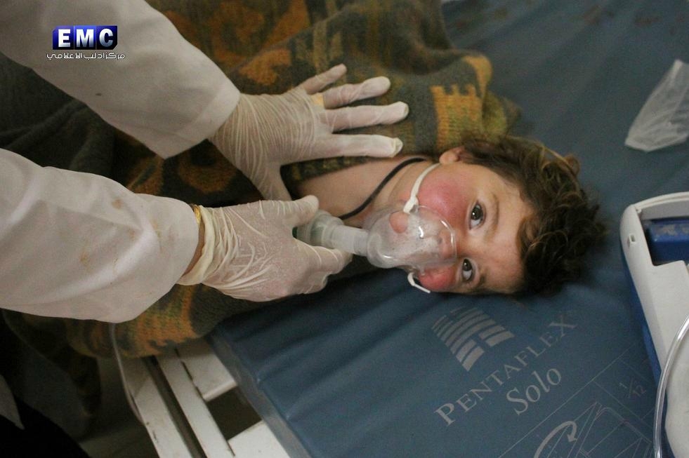 
En av de skadade efter den misstänkta kemvapenattacken i Syrien. Foto: AP/TT                                            
