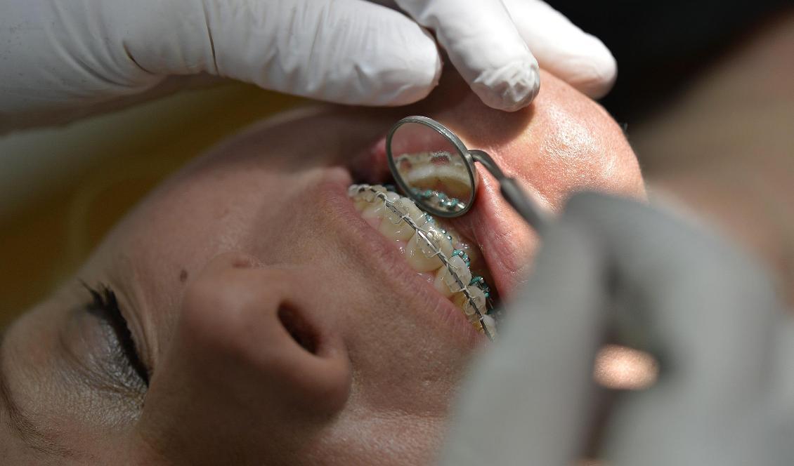 Tanken med det statliga tandvårdsstödet är att en patient inte ska behöva stå för hela kostnaden vid dyra ingrepp. Foto: Anders Wiklund/TT-arkivbild