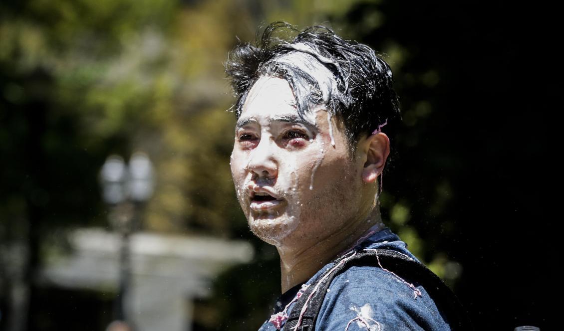 








Andy Ngo, en Portland-baserad journalist, har fått ansiktet täckt av en okänd sörja, efter att medlemmar i den autonoma vänsterrörelsen Rose City Antifa, attackerade honom den 29 juni 2019 i Portland i delstaten Oregon, USA. Foto: Moriah Ratner/Getty Images                                                                                                                                                                                                                                                                                                                                                                                                            