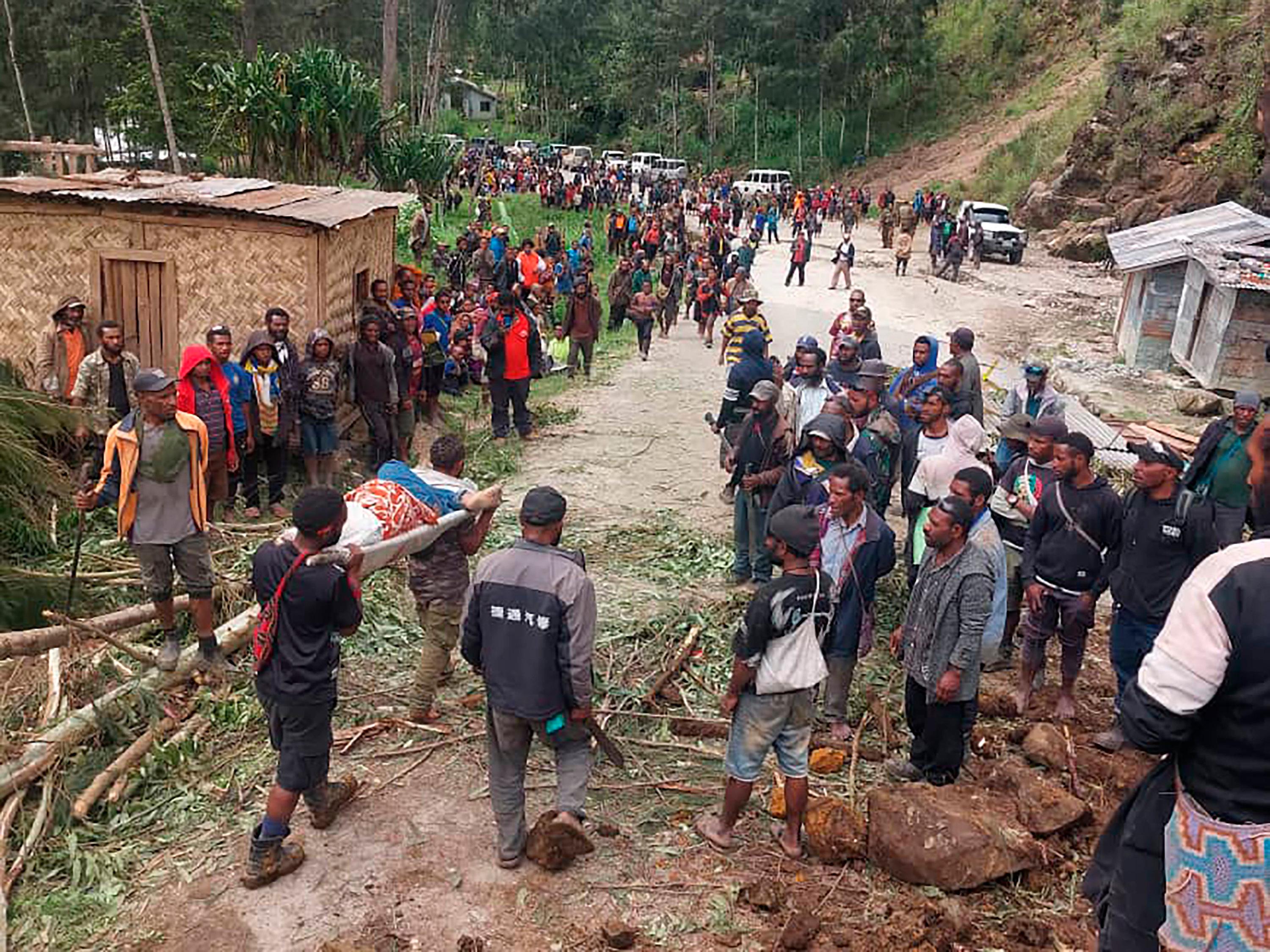 En skadad person förs bort på bår efter det stora jordskredet i Papua Nya Guinea. Bilden från i fredags kommer från FN:s migrantorgan IOM. Foto: Benjamin Sipa/AP/TT