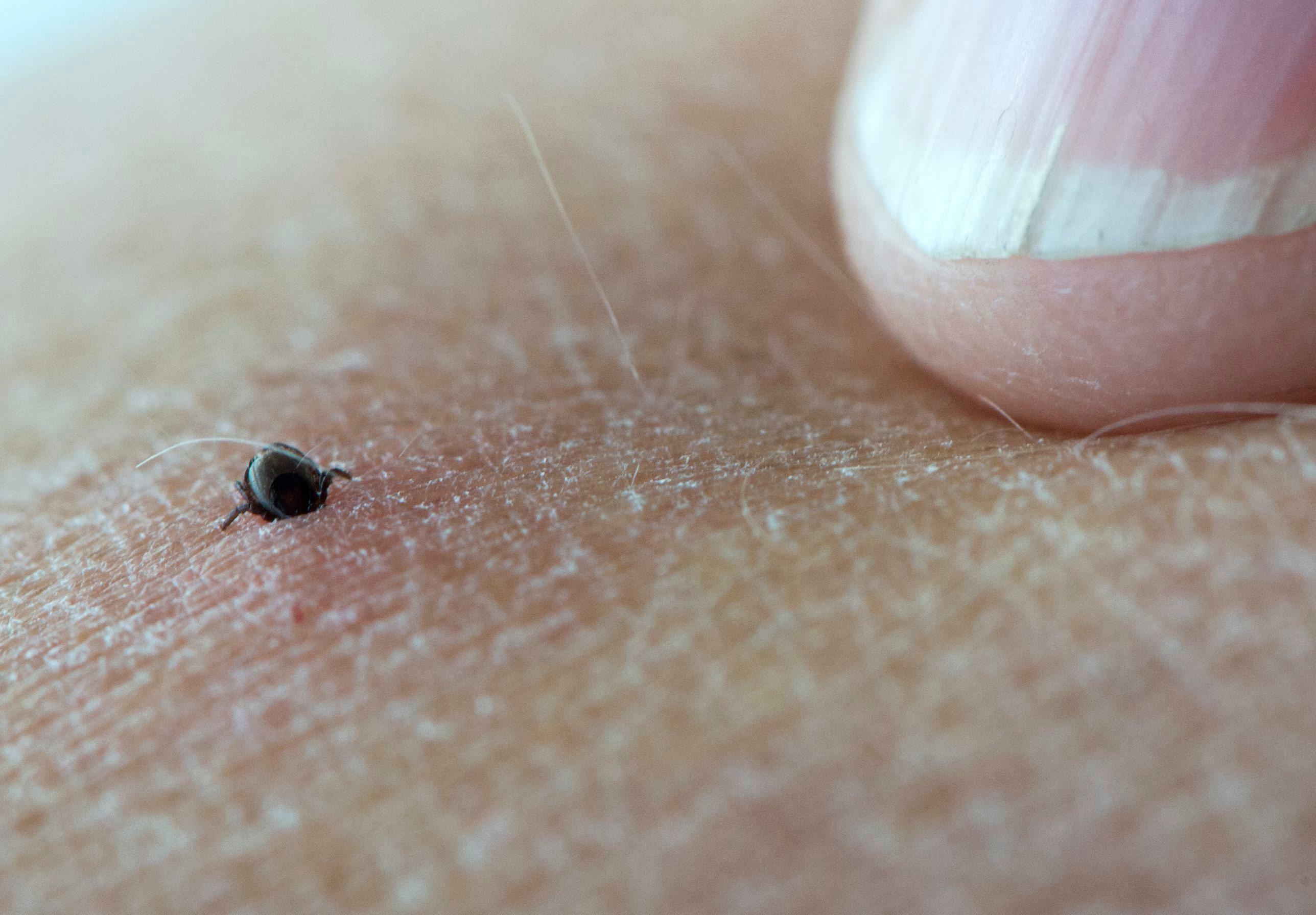 Fästingar är spridare av sjukdomarna borrelia och TBE. Nu undersöks kopplingen till cancer. Arkivbild. Foto: Fredrik Sandberg/TT