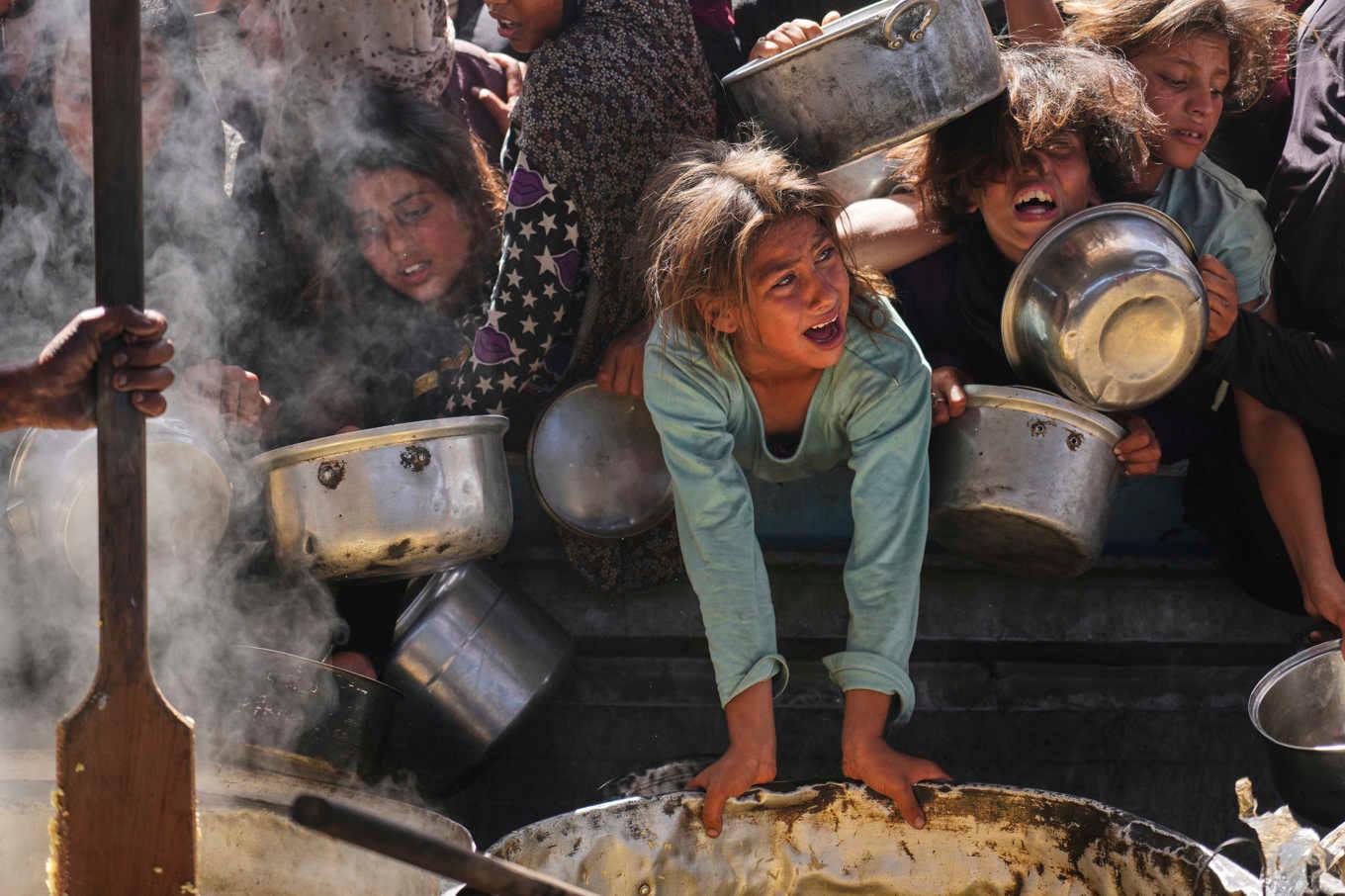 De senaste veckorna har otaliga bilder publicerats på barn som tydligt är påverkade av matbristen i Gaza. Foto: Abdel Kareem Hana/AP/TT