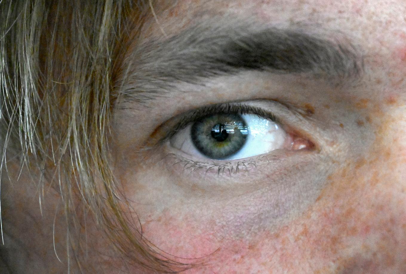 Pupillerna regerar utan att vi styr dem. Kanske de kan bli framtidens diagnosverktyg. Arkivbild. Foto: Janerik Henriksson/TT