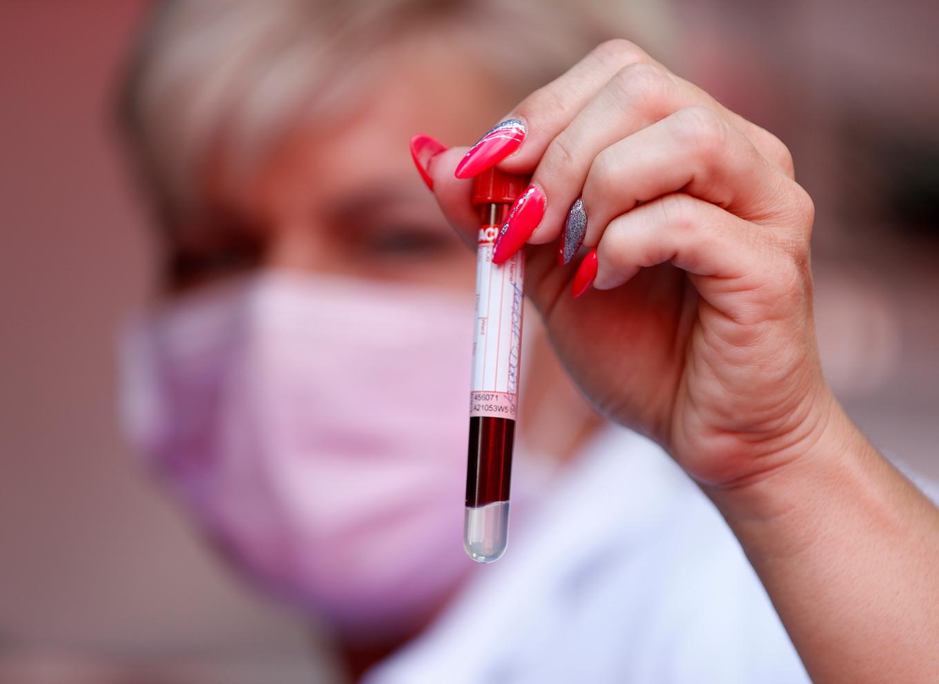Med ett blodprov skulle man i framtiden kunna avslöja flera allvarliga sjukdomar, som cancer och autoimmuna sjukdomar. Arkivbild. Foto: Laszlo Balogh/AP/TT