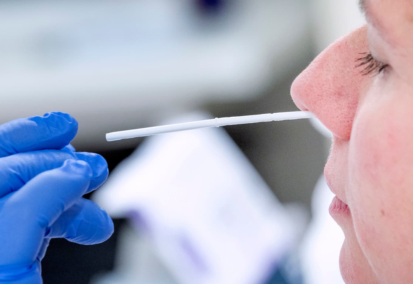 En ny studie från Sahlgrenska akademin visar att en bakgrund av ohälsa kan spela roll för vem som får postcovid. Arkivbild. Foto: Johan Nilsson/TT