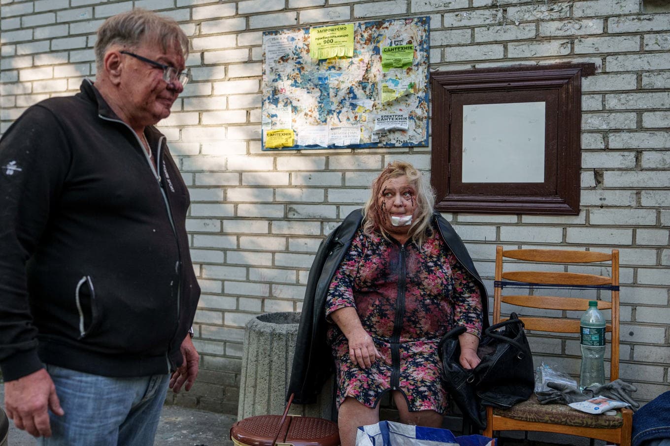 Olena Dniprovska och maken Jevhen Dniprovskyj, som båda skadades i nattens ryska attacker, framför sitt hus i Kiev. Foto: Evgeniy Maloletka/AP/TT