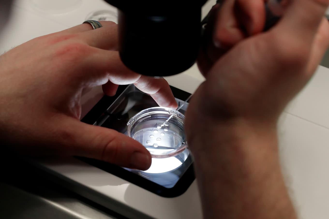 Vid IVF sker befruktning av ägget på labb och embryot förs sedan in i kvinnans kropp. Arkivbild Foto: Michael Wyke/AP/TT