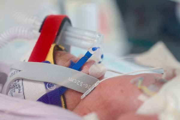 En av enäggsfyrlingarna som föddes 14 juli i ett sjukhus i Brisbane, Australien. De vårdas på sjukhusets specialiserade neonatalavdelning. Foto: Foto: Royal Brisbane and Women's hospital