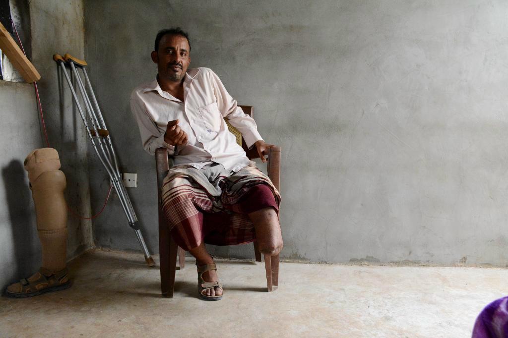 
Mocktar fick en benprotes efter att ha klivit på en landmina i sin hemstad Karesh. Foto: Malak Shaher/Läkare utan gränser/TT-arkivbild                                            