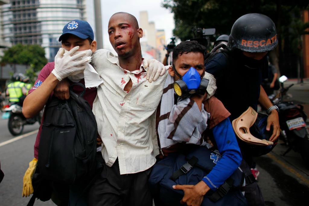 En man som skadats i samband med de våldsamma protesterna i Venezuela på torsdagen får hjälp. Foto: Ariana Cubillos/AP/TT
