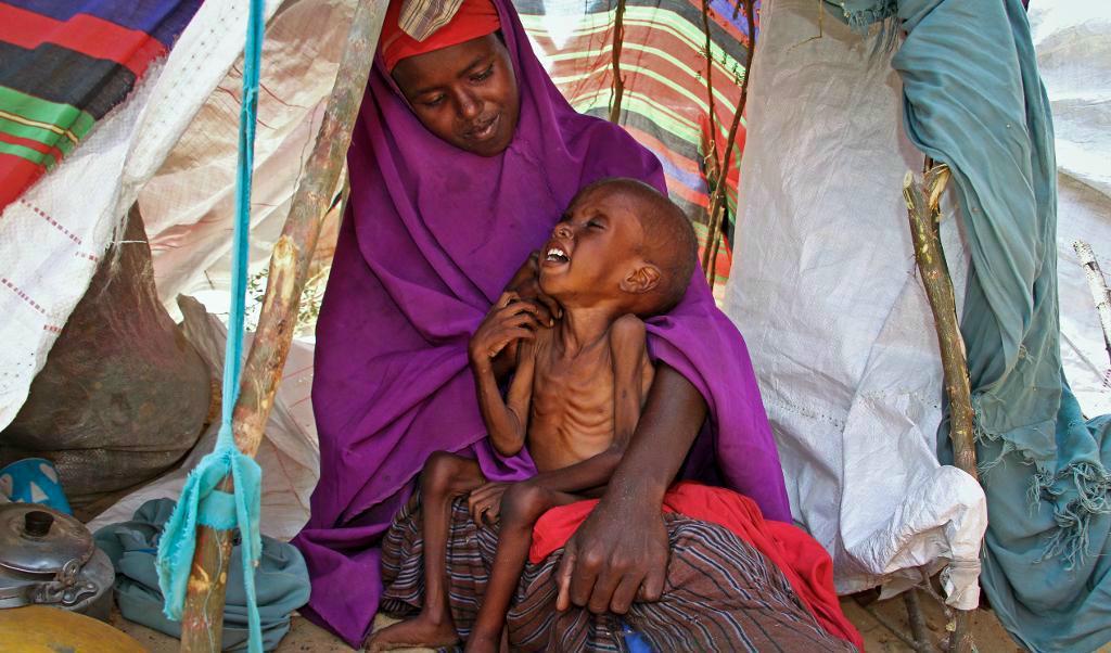 En mamma försöker trösta sin undernärda sjuårige son, efter att de flytt undan strider och hungersnöd till Somalias huvudstad Mogadishu i slutet av mars. Arkivbild. Foto: Farah Abdi Warsameh/AP/TT