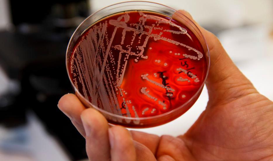 
Antibiotikaresistenta bakterier utgör ett allt större hälsoproblem världen över. Behovet av nya antibiotikavarianter är stort. Foto: Poppe, Cornelius                                            