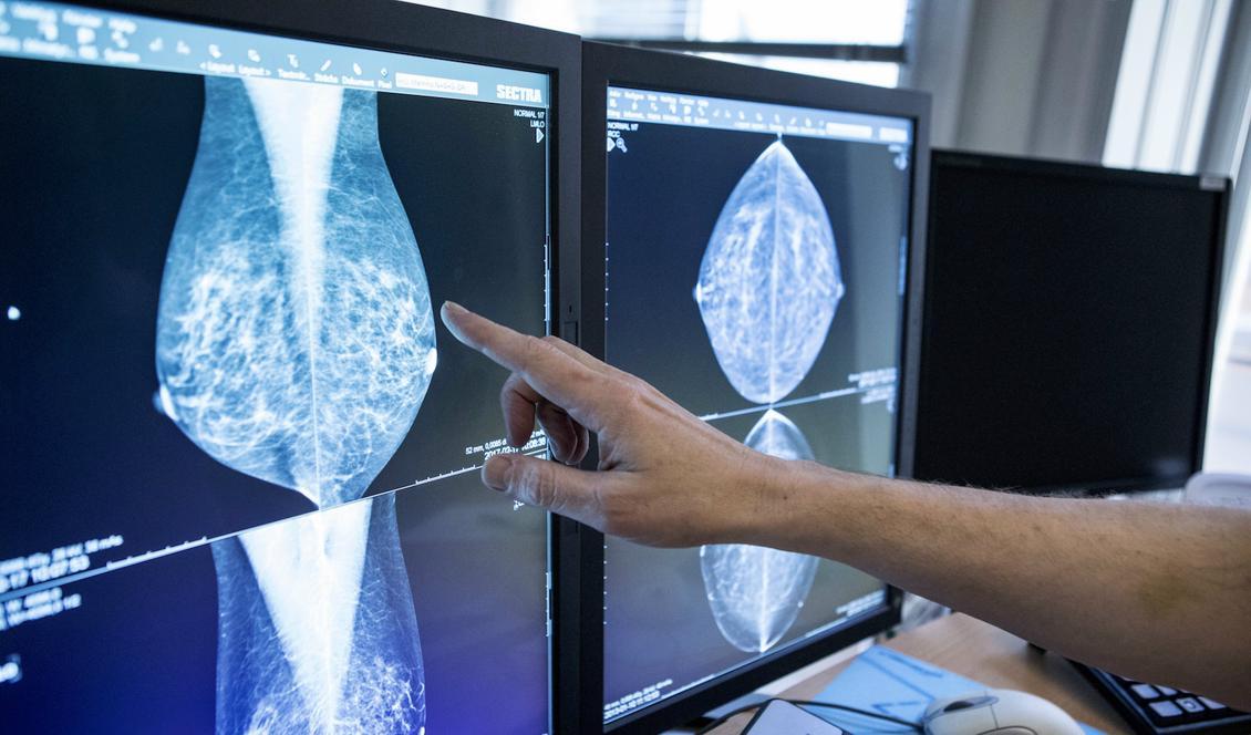 




En läkare tittar på mammografibilder. Foto: Christine Olsson/TT/Arkivbild.                                                                                                                                                                                                                            