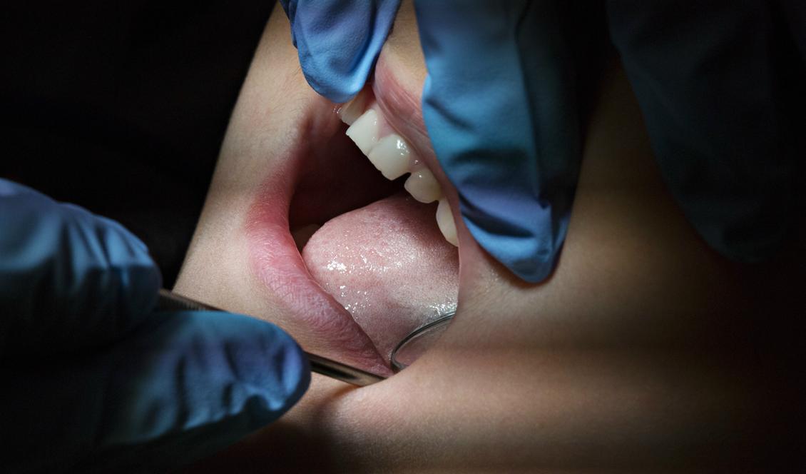 Flera tandläkare har åtalats och dömts för bidragsbrott. Foto: Martina Holmberg/TT