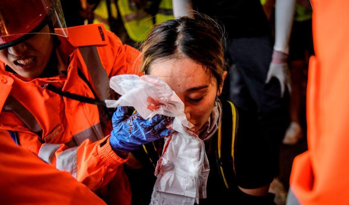 

Läkare hjälper en kvinna som blivit beskjuten i ögat av polis i Hongkong den 11 augusti 2019. Foto: Anthony Wallace/AFP/Getty Images                                                                                                 