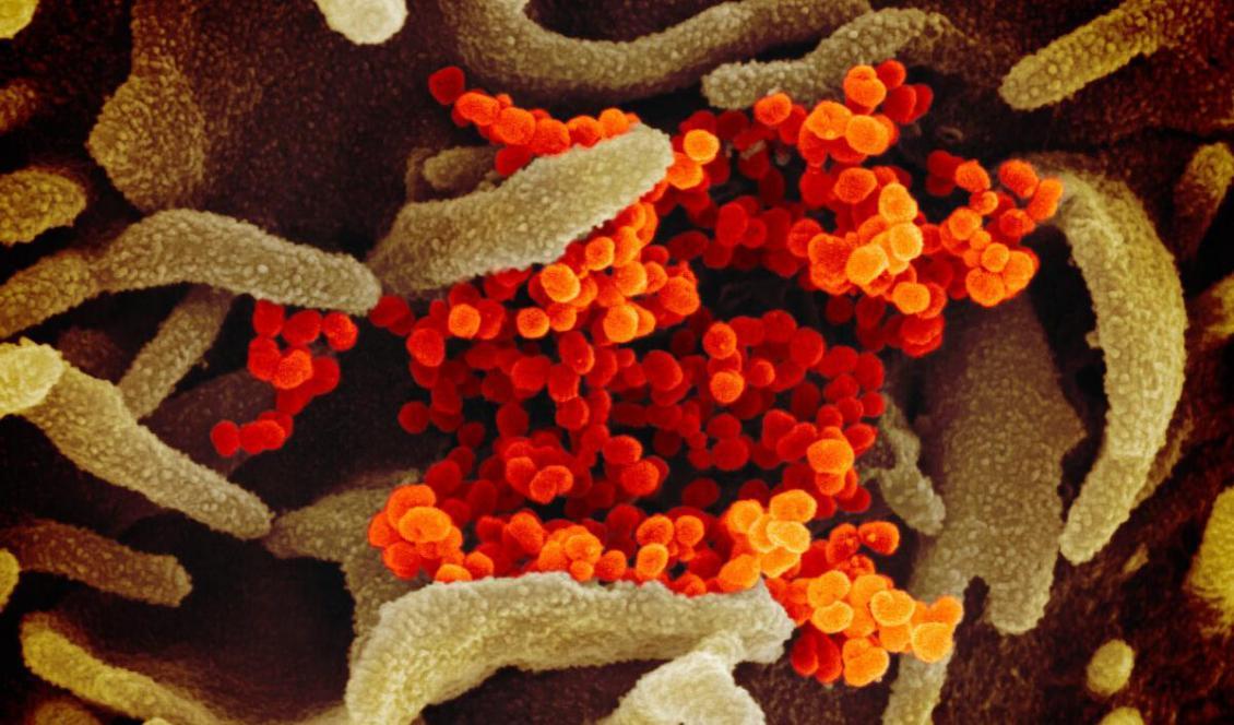 



Bild tagen med svepelektronmikroskop av SARS-CoV-2 (orange) på ytan av celler (grön) i ett prov från en covid-19-patient i USA, odlat i laboratorium. Bilden publicerades den 13 februari 2020. Foto: NIAID-RML                                                                                                                                                                                                