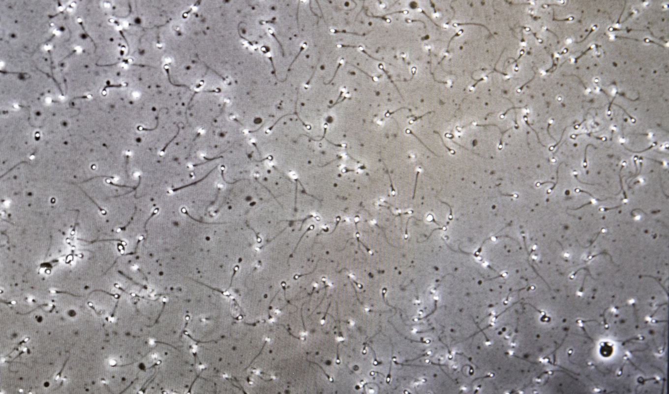 Gemensamt för de fem männen är att de genomgick fertilitetsbehandling – men ingen av dem hade sagt ja till att donera spermier. Arkivbild. Foto: Gorm Kallestad/NTB/TT