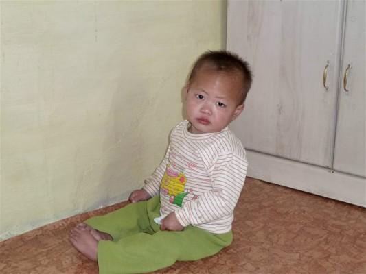 Bild från i maj 2011 som visar ett barn som lider av undernäring på ett barnhem i Nordkorea. Barnhemmet tar hand om barn under 5 år som är föräldralösa eller vars föräldrar inte kan försörja barnen. (Foto: AFP/HO)

