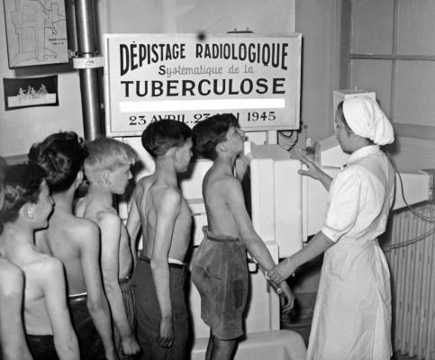 Tbc-undersökning av barn i Paris, Frankrike 1945. (Foto:AFP/N&amp;B)