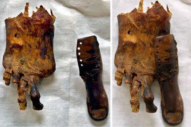 Amputerad mumietå, 3 500 år gammal, finns på museum i Kairo. (Foto: AFP)