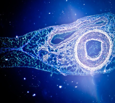 Mikrofotografi av ett blodkärl. (Foto: Shutterstock*)