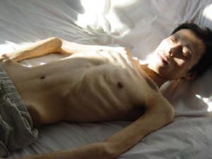 I Kina blir tusentals Falun Gong-utövare årligen offer för organstölder. Zhang Zhong (bilden) är ett av tusentals kända fall av Falun Gong-utövare som dött till följd av tortyr i kinesiska fängelser och arbetsläger. (Foto: www.faluninfo.net)

