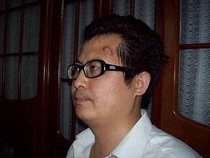 Guo Feixiong, fotot taget 2006 efter att Guo blivit misshandlad av polis. (fotot kommer från en av Guos vänner).
