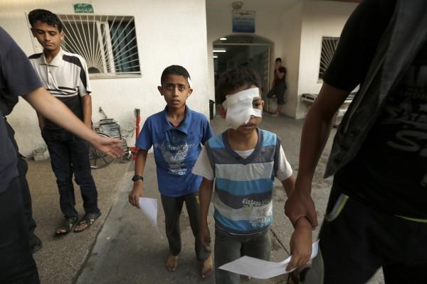 Två skadade palestinska barn som tagit skydd på en FN-skola som attackerades av granater får behandling vid Kamal Edwan sjukhuset i Beit Lahia i norra Gazaremsan tidigt den 31 juli. (Foto: Mohammed Abed /AFP / Getty Images)
